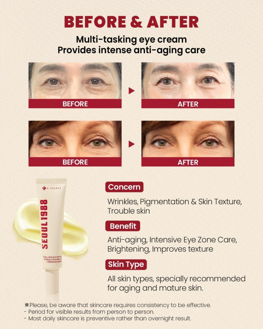 [KSECRET] Seoul 1988 Eye Cream – Retinal Liposome 4% + Fermented Bean