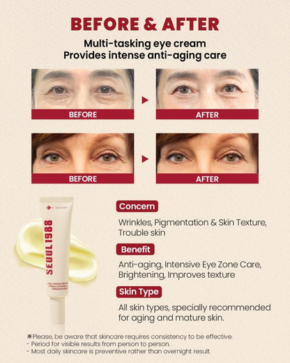 [KSECRET] Seoul 1988 Eye Cream – Retinal Liposome 4% + Fermented Bean